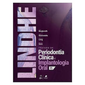 Tratado De Periodontia Clinica E Implantologia Oral