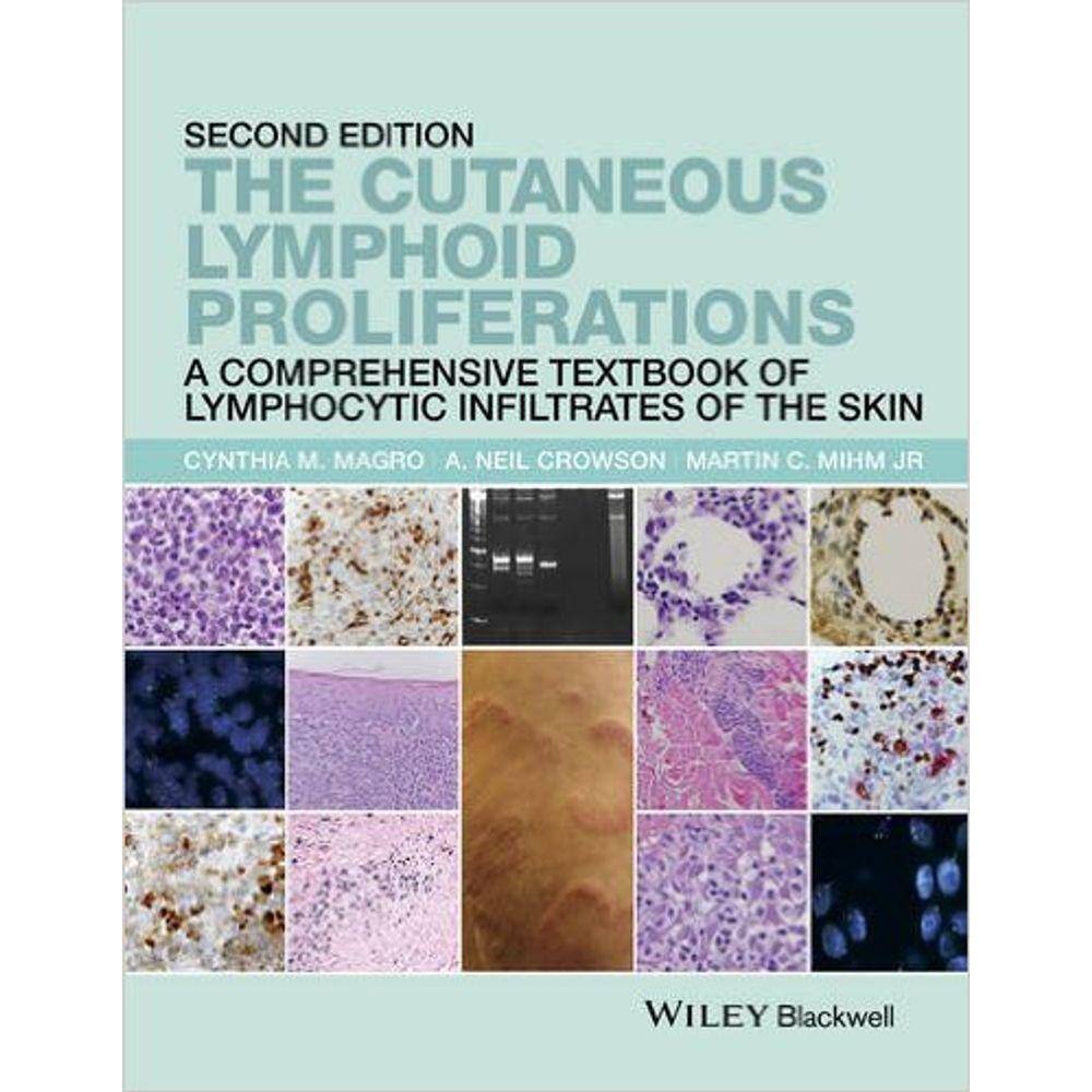 The Cutaneous Lymphoid Proliferations: A Comprehensive Textbook Of Lymphocy