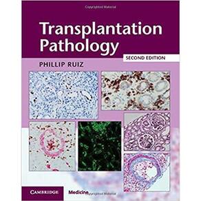 Transplantation Pathology