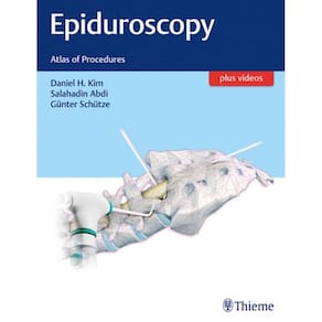 Epiduroscopy