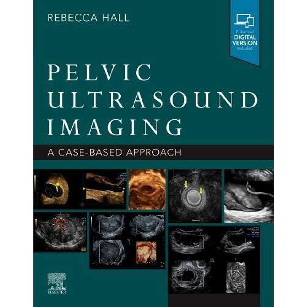 Pelvic Ultrasound Imaging