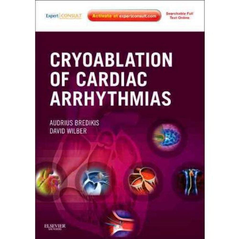Cryoablation Of Cardiac Arrhythmias
