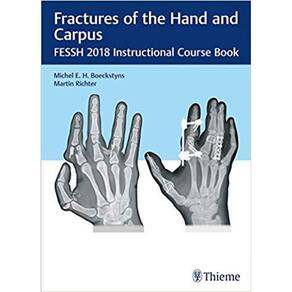 Fractures Of The Hand And Carpus: Fessh 2018 Instructional Course Book