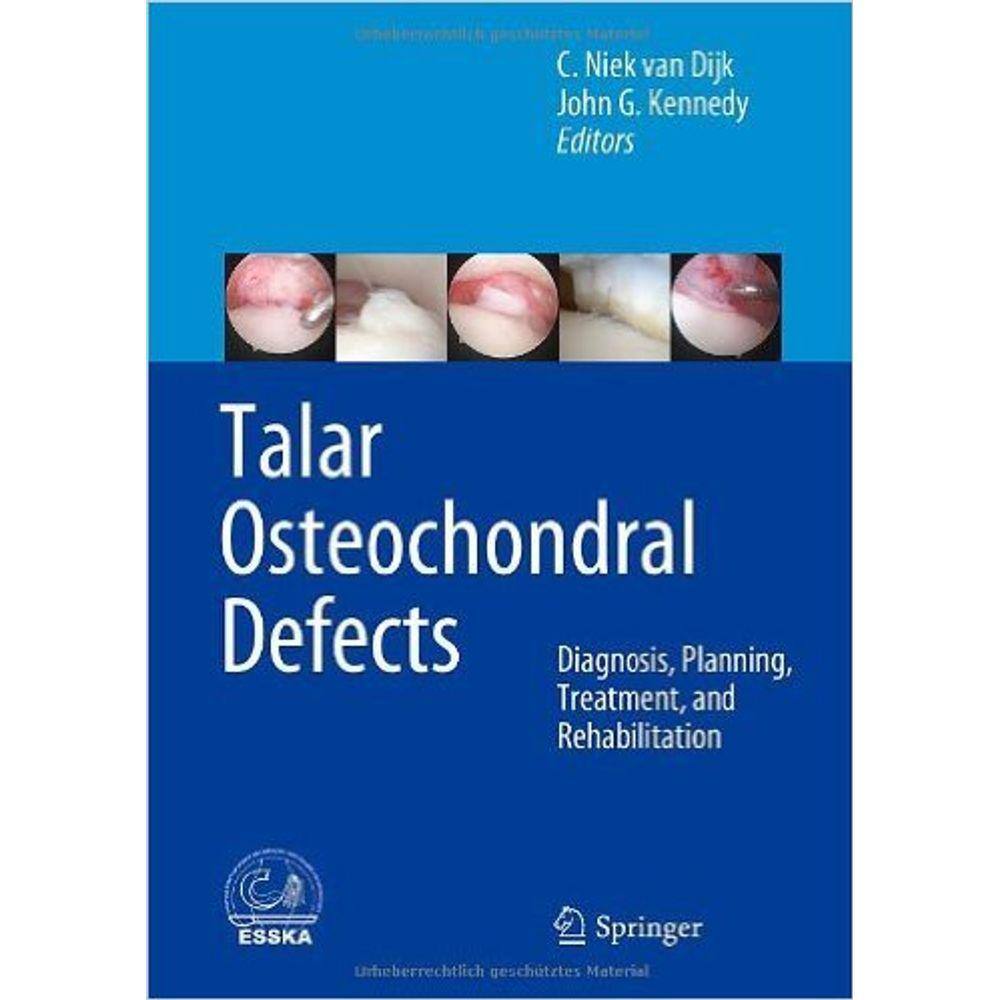 Talar Osteochondral Defects