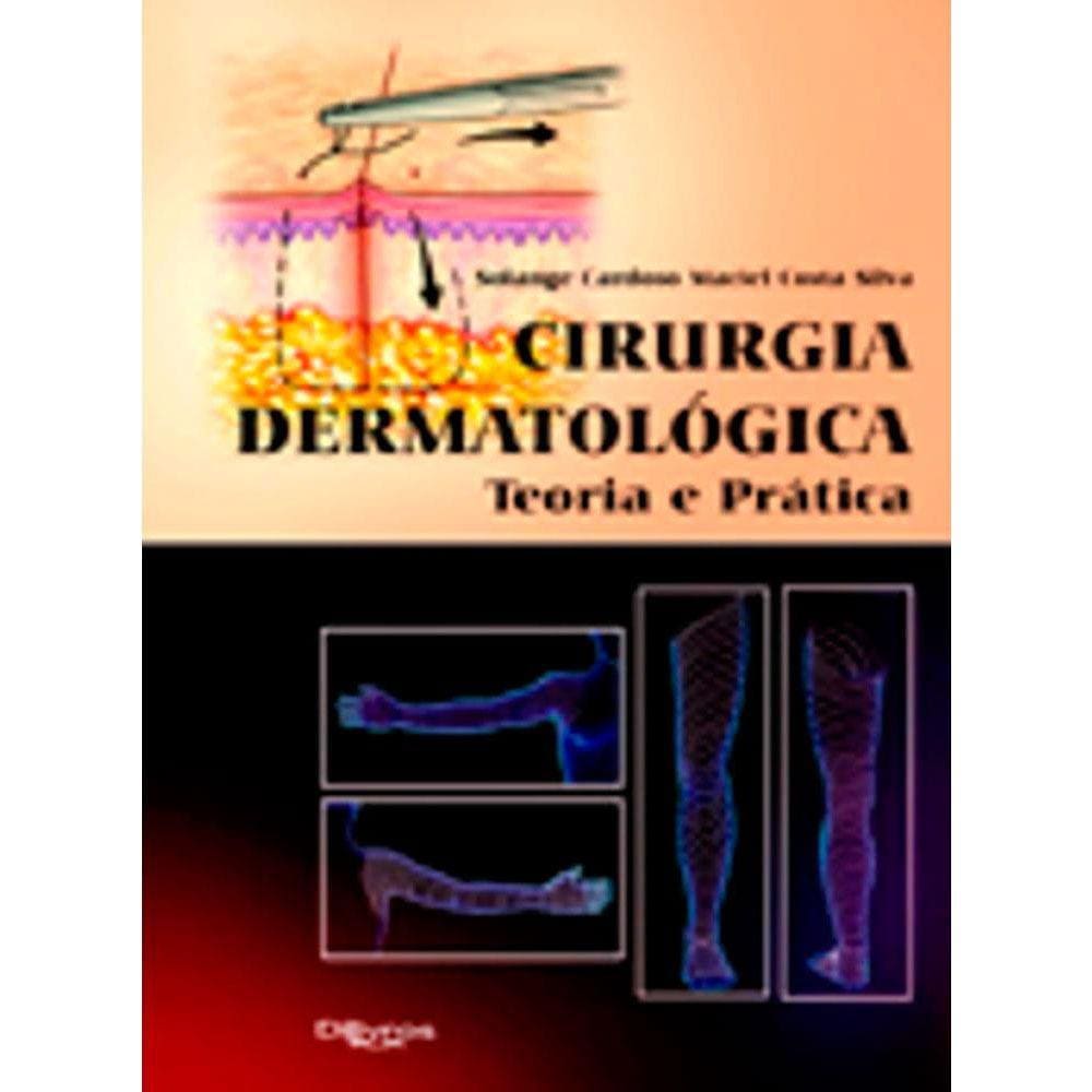 Cirurgia Dermatologica Teoria E Pratica