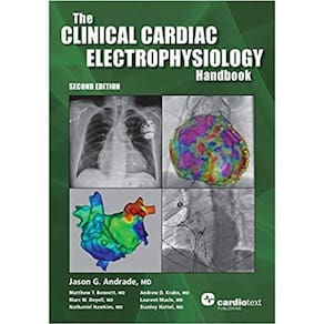 The Clinical Cardiac Electrophysiology Handbook