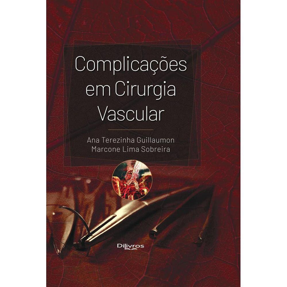 Complicacoes Em Cirurgia Vascular