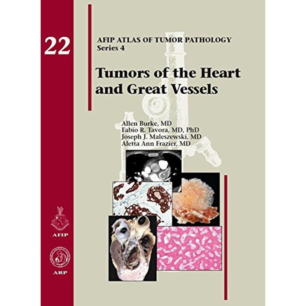 Tumors Of The Heart And Great Vessels