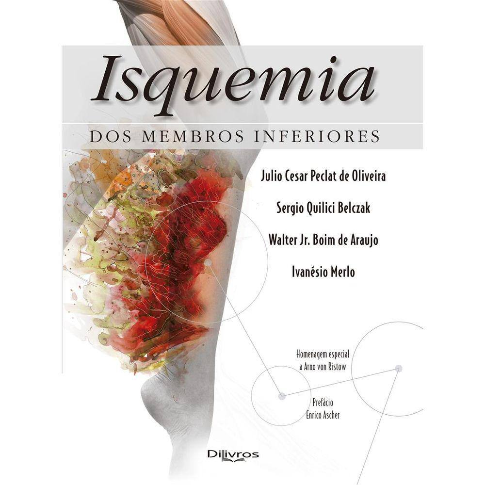 Isquemia Dos Membros Inferiores