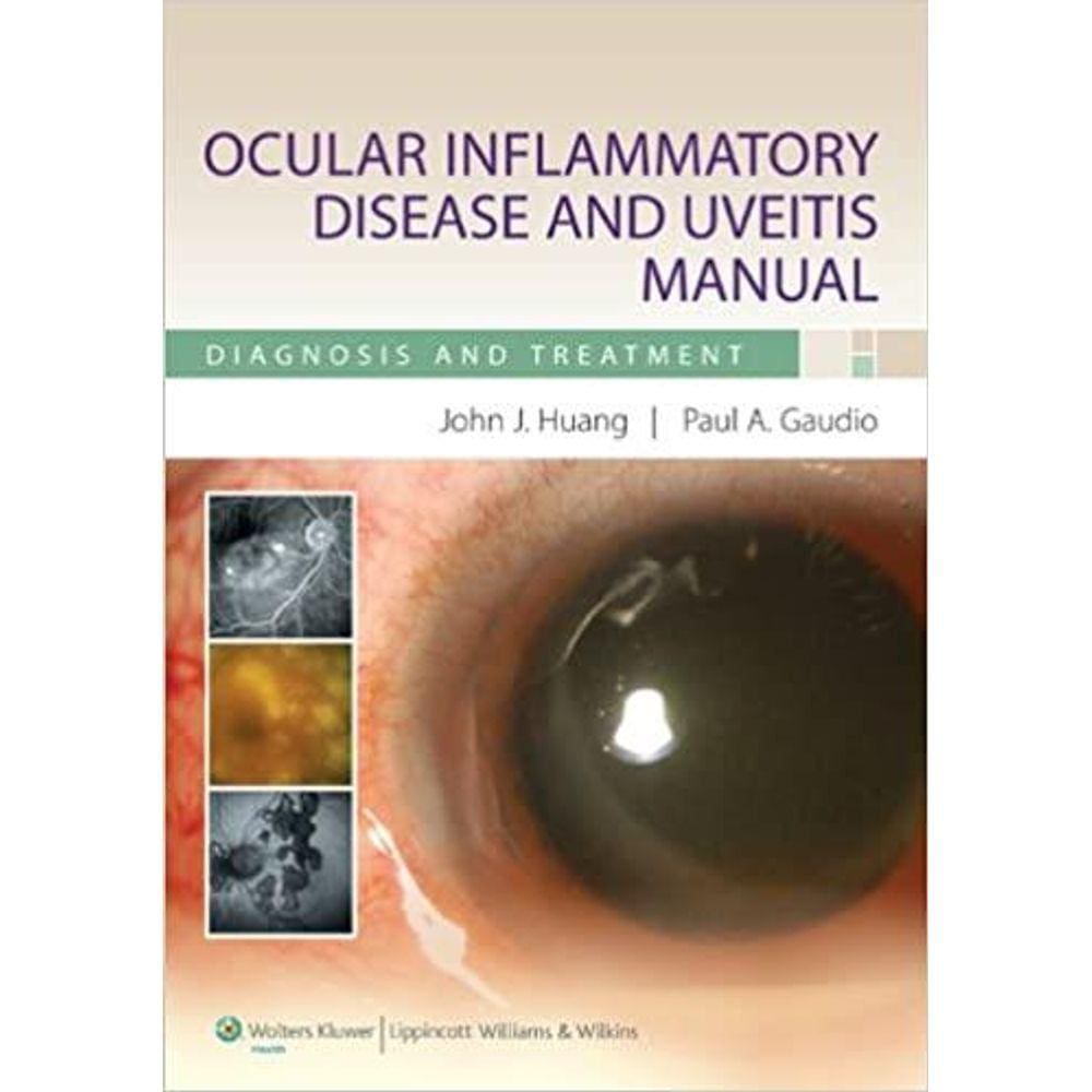 Ocular Inflammatory Disease And Uveitis Manual