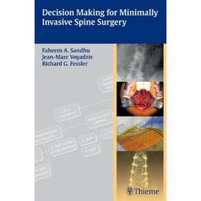 Decision Making For Minimally Invasive Spine