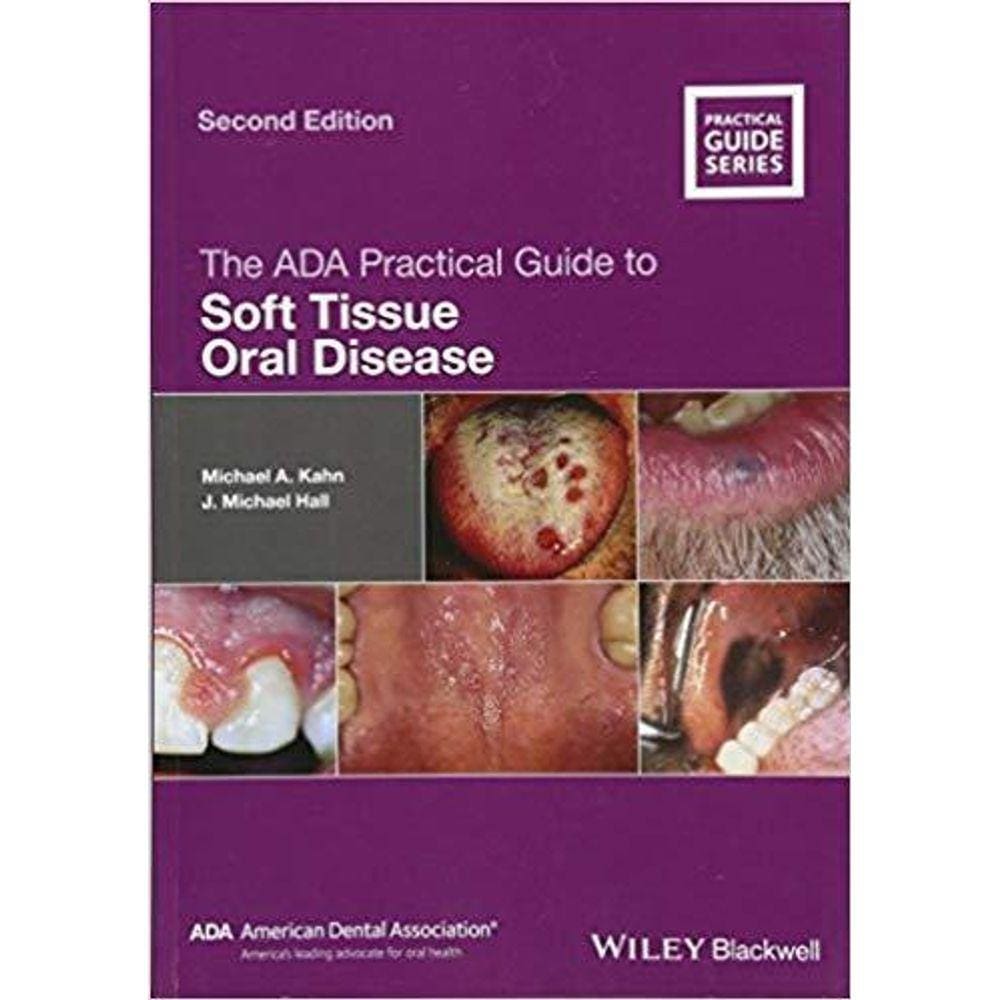 The Ada Practical Guide To Soft Tissue Oral Disease