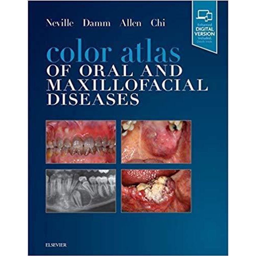 Color Atlas of Oral and Maxillofacial Diseases