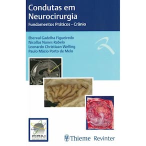 Condutas Em Neurocirurgia Fund Praticos Cranio