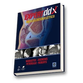 Expertddx Musculoesqueletico Serie Expert Differential Diagnoses