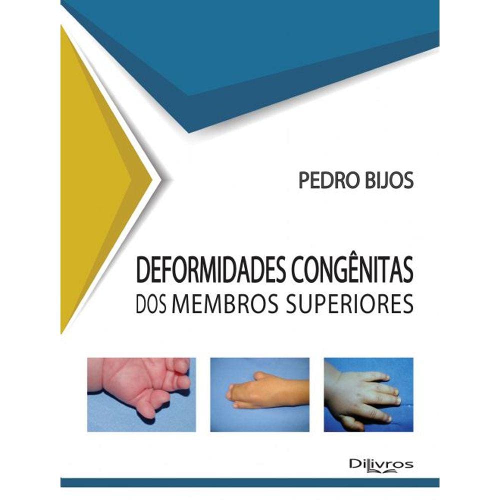 Deformidades Congenitas Dos Membros Superiores