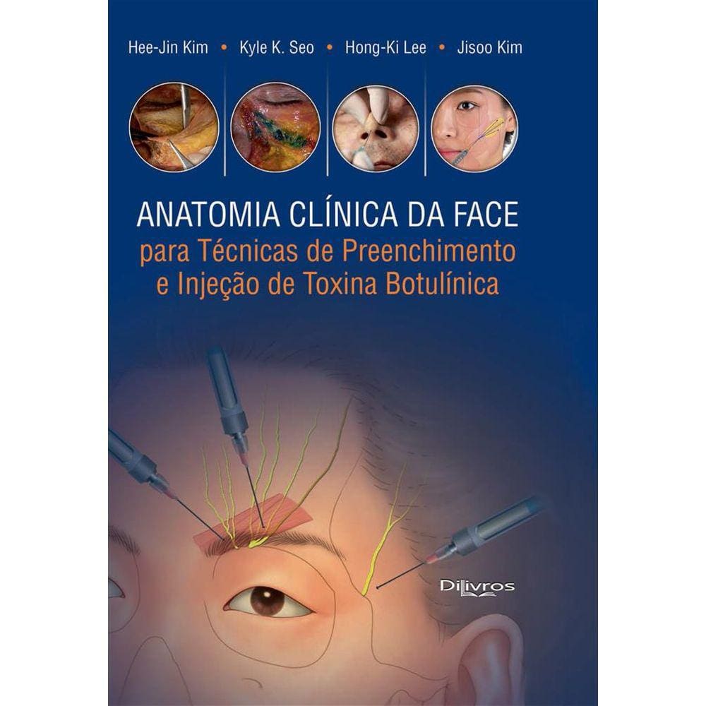 Anatomia Clinica Da Face Para Tec De Preench E Inj De Toxina Botulinica