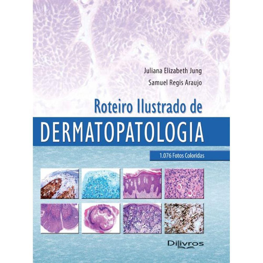 Roteiro Ilustrado De Dermatopatologia