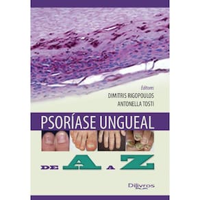 Psoriase Ungueal De A A Z