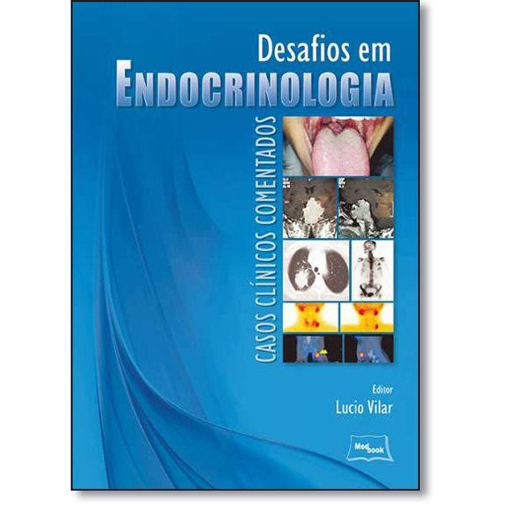 Desafio Em Endocrinologia  - Casos Clinicos Comentados
