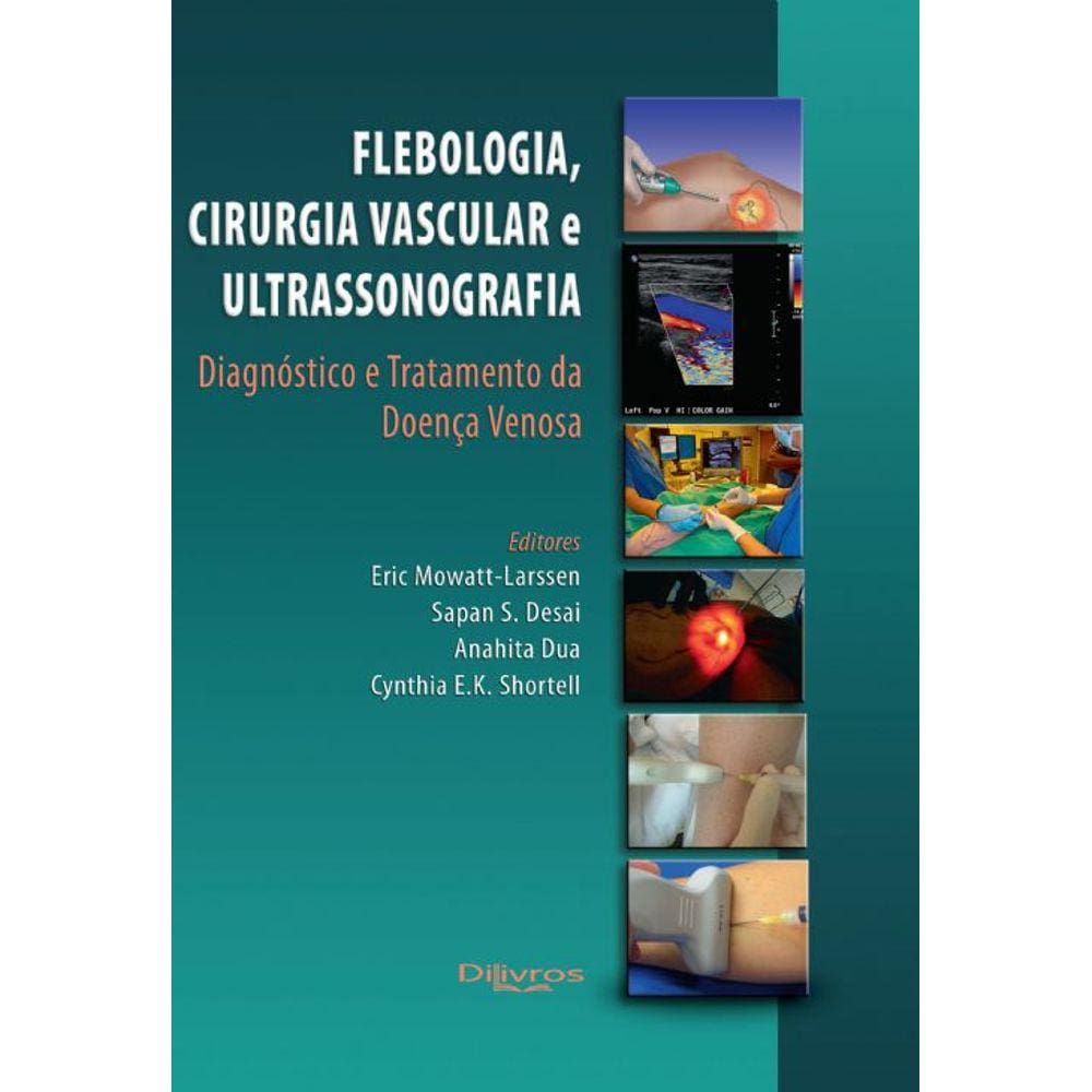 Flebologia Cirurgia Vascular E Ultrassonografia Diagnostico E Tratamento