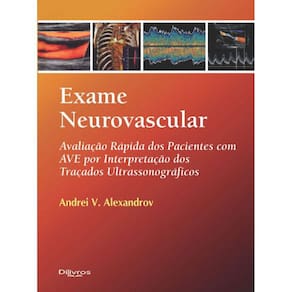 Exame Neurovascular Avaliacao Rapido Dos Pacientes Com Ave Por Interpreta