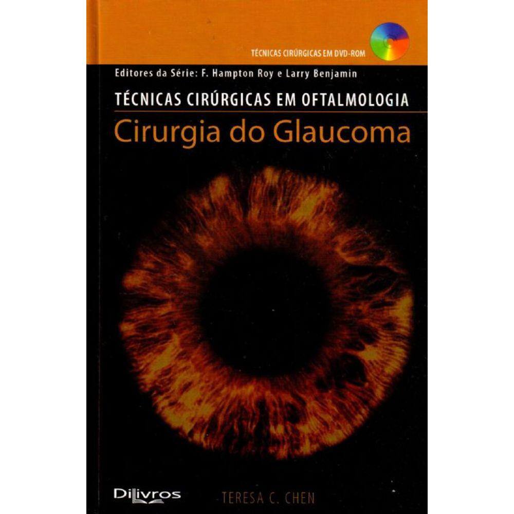 Cirurgia Do Glaucoma