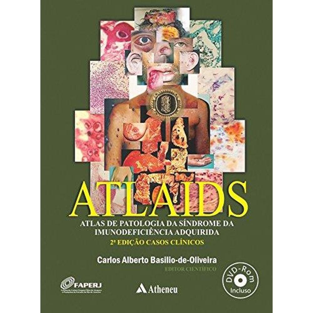Atlaids - Atlas De Patologia Da Síndrome Da Imunodeficiência Adquirida (Aids/Hiv) 2a Edição - Casos