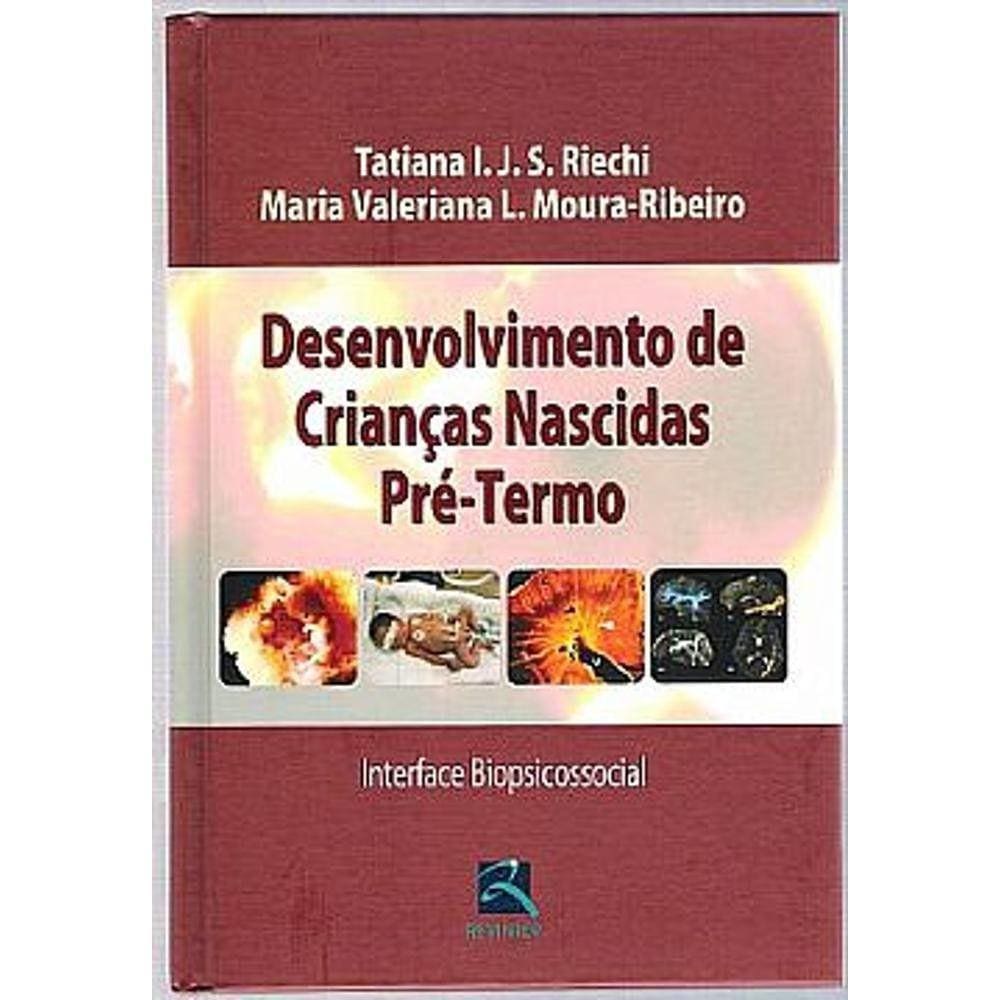 Desenvolvimento De Criancas Nascidas Pre Termo