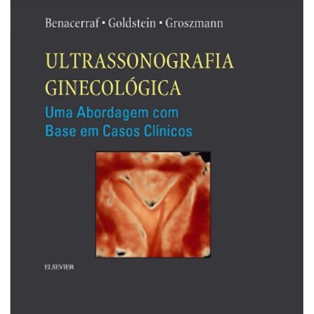Ultrassonografia Ginecológica