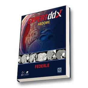 Expertddx Abdome Serie Expert Differential Diagnoses