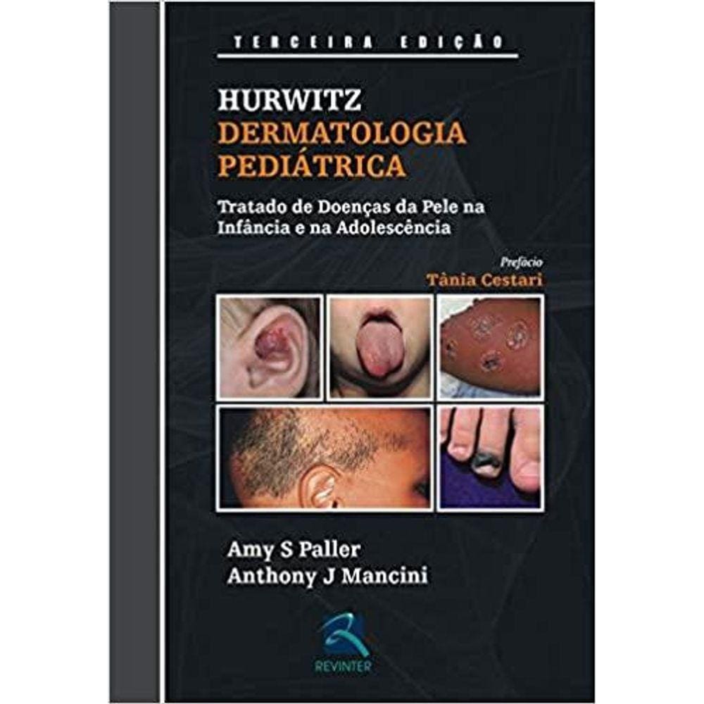 Dermatologia Pediatrica