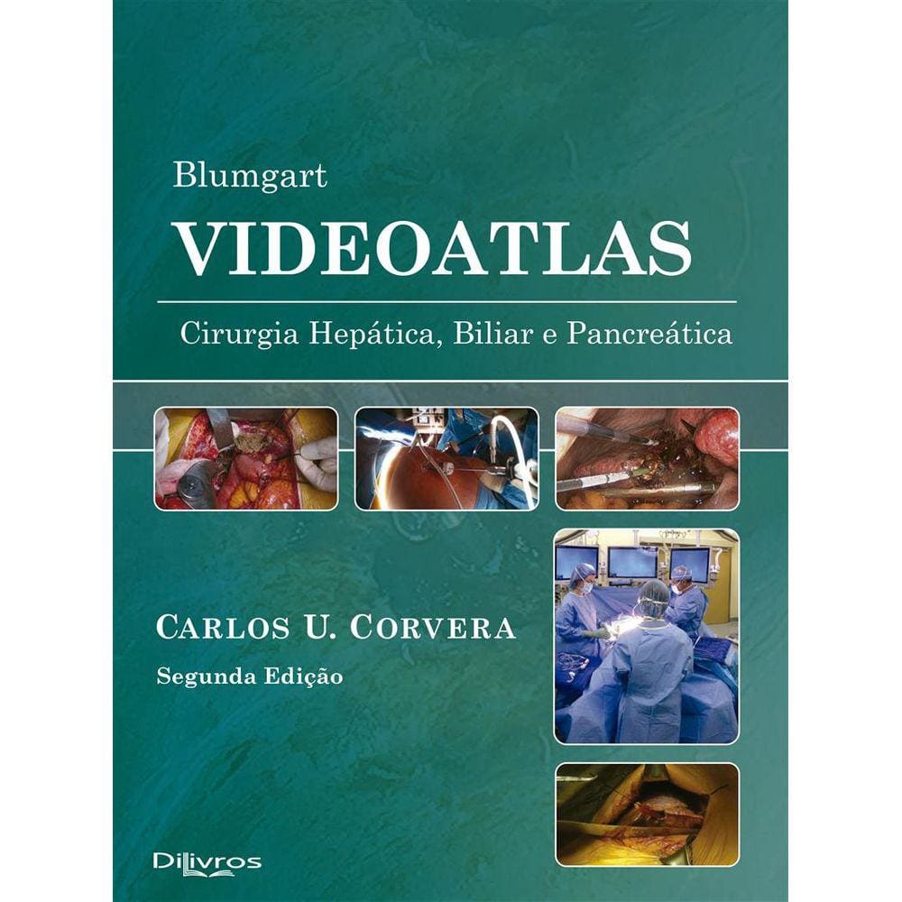 Blumgart Videoatlas