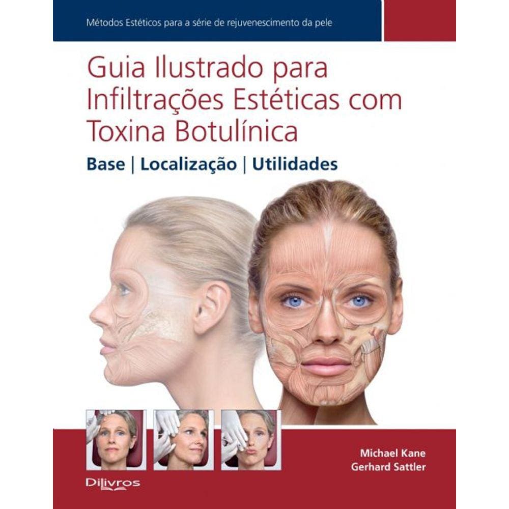 Guia Ilustrado Para Infiltracoes Esteticas Com Toxina Botulinica