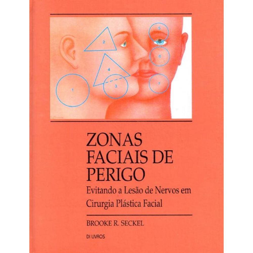 Zonas Faciais de Perigo: Evitando a Lesão de Nervos em Cirurgia Plástica Facil