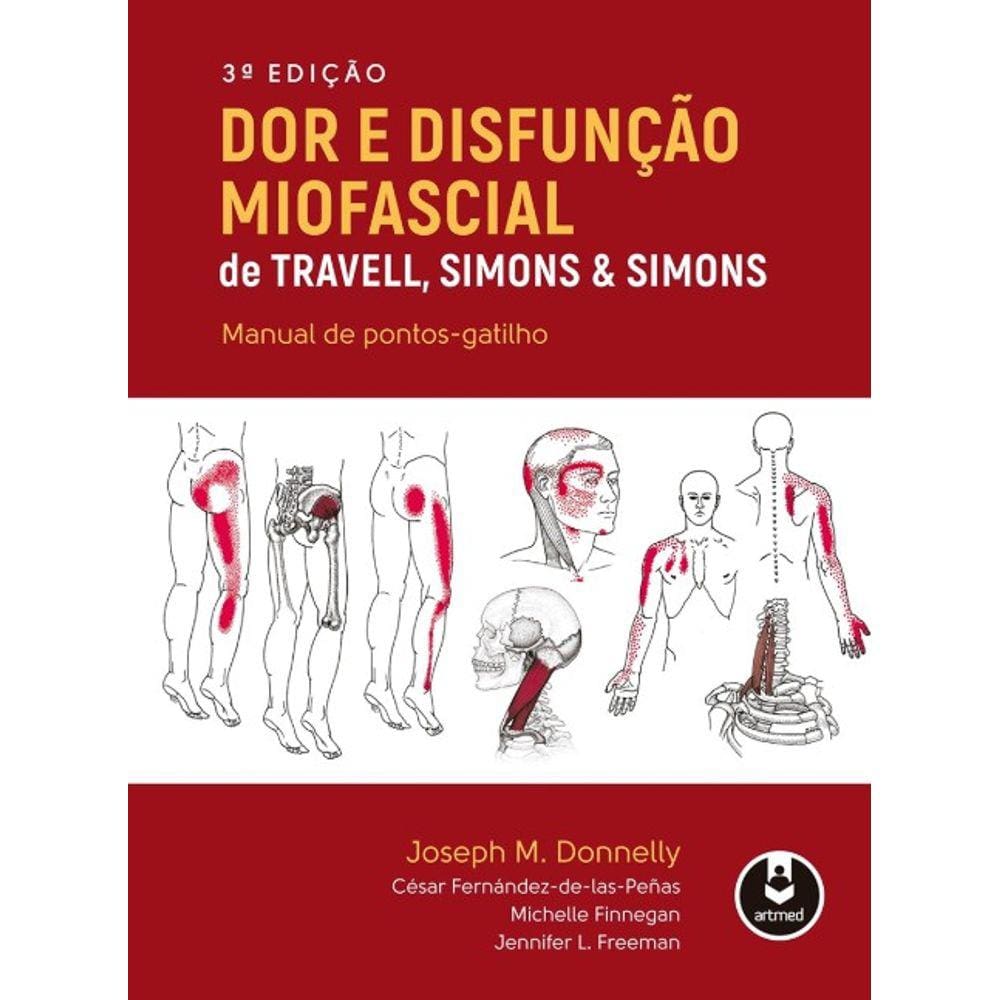 Dor E Disfuncao Miofascial De Travell Simons & Simons