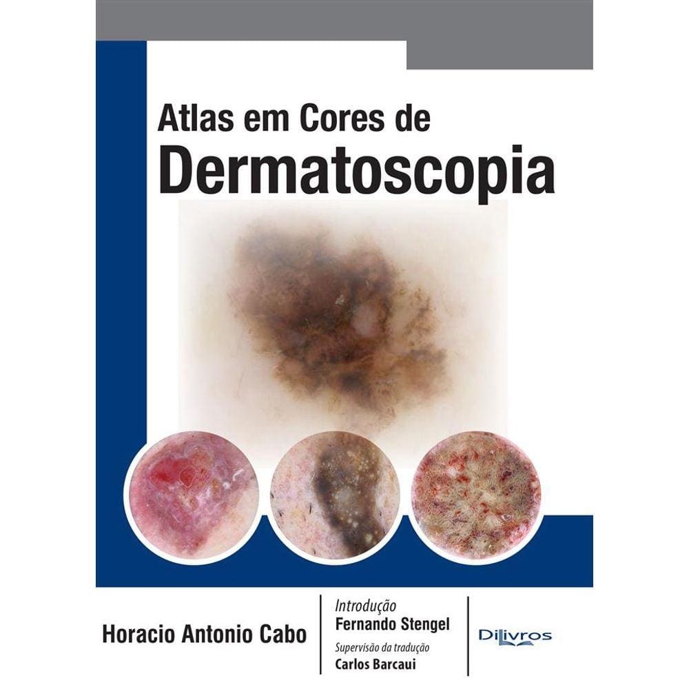Atlas Em Cores De Dermatoscopia