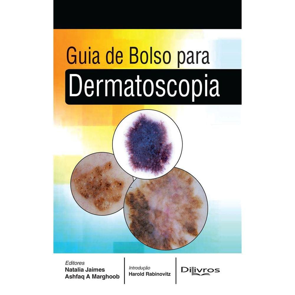 Guia De Bolso Para Dermatoscopia