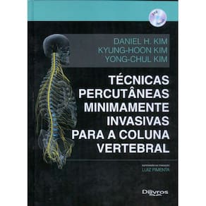 Tecnicas Percutaneas Minimamente Invasivas Para Coluna Vertebral