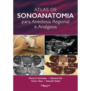 Atlas De Sonoanatomia Para Anestesia Regional E Analgesia