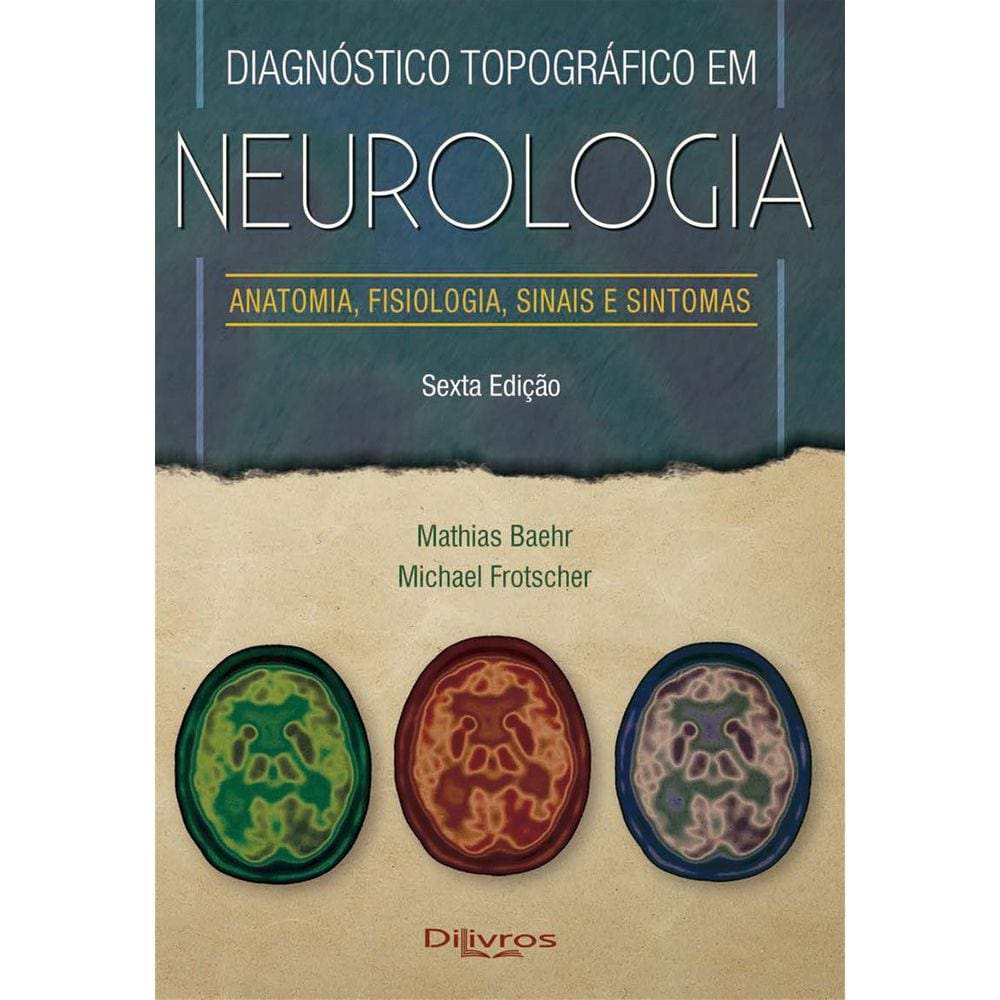 Diagnostico Topografico Em Neurologia