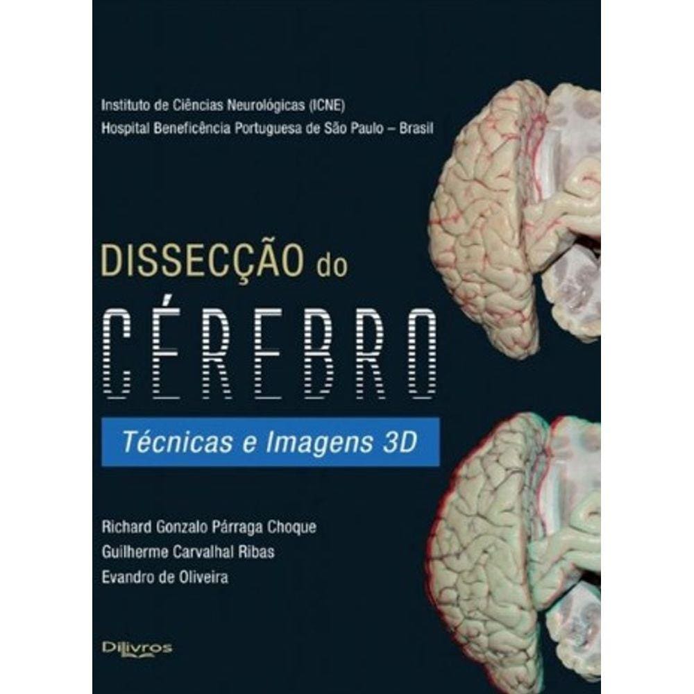 Disseccao Do Cerebro Tecnicas E Imagens 3D