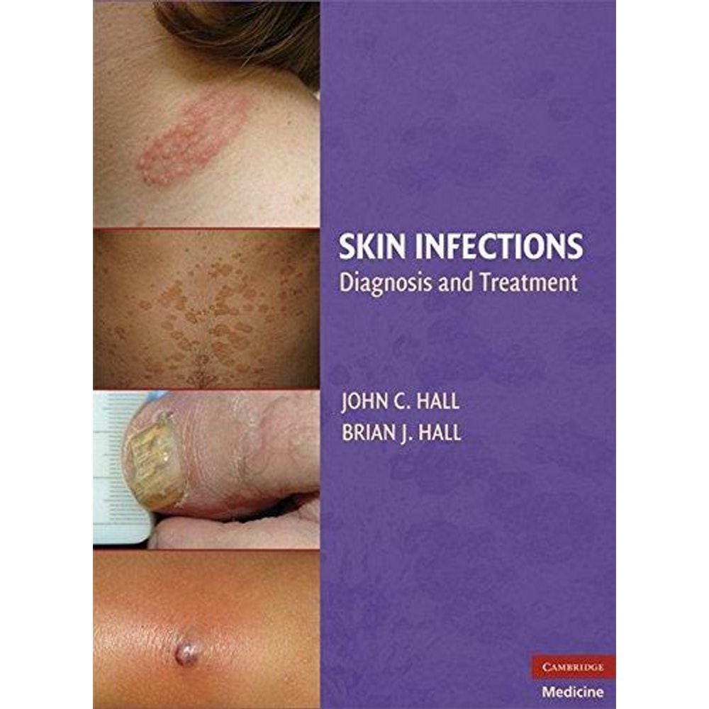 Skin Infections