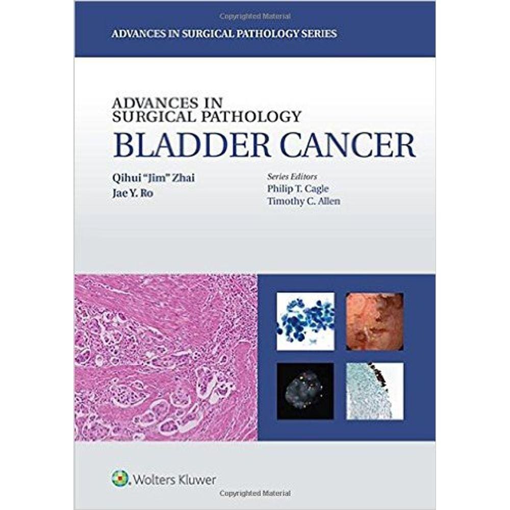 Advances In Surgical Pathology: Bladder Cancer