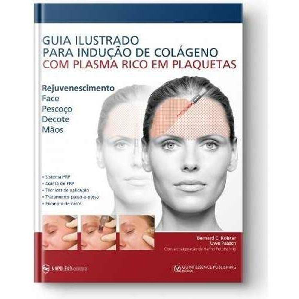 Guia Ilustrado Para Indução De Colágeno Com Plasma Rico Em Plaquetas