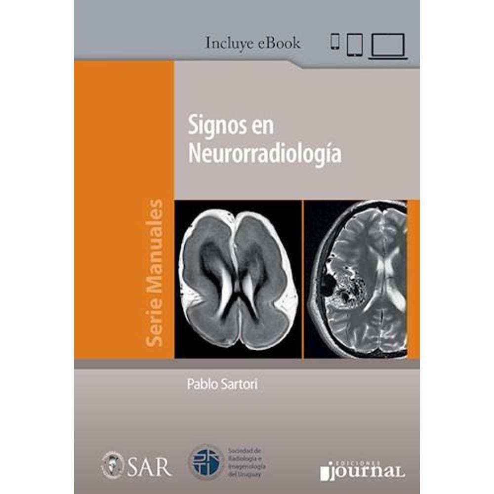 Signos En Neurorradiologia (Espanhol)