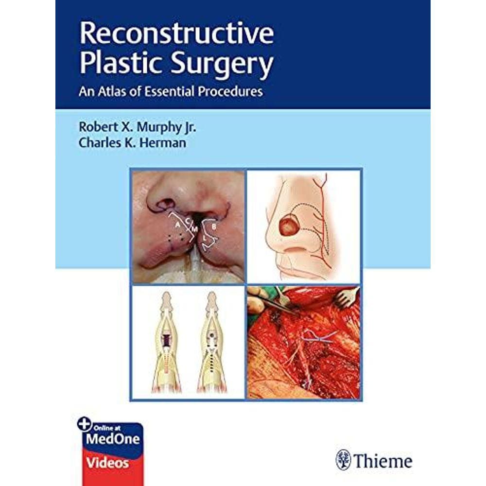 Reconstructive Plastic Surgery