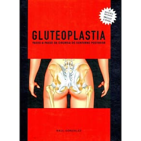 Gluteoplastia Passo A Passo Da Cirurgia Do Contorno Posterior