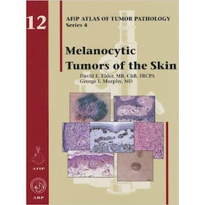 Melanocytic Tumors Of The Skin