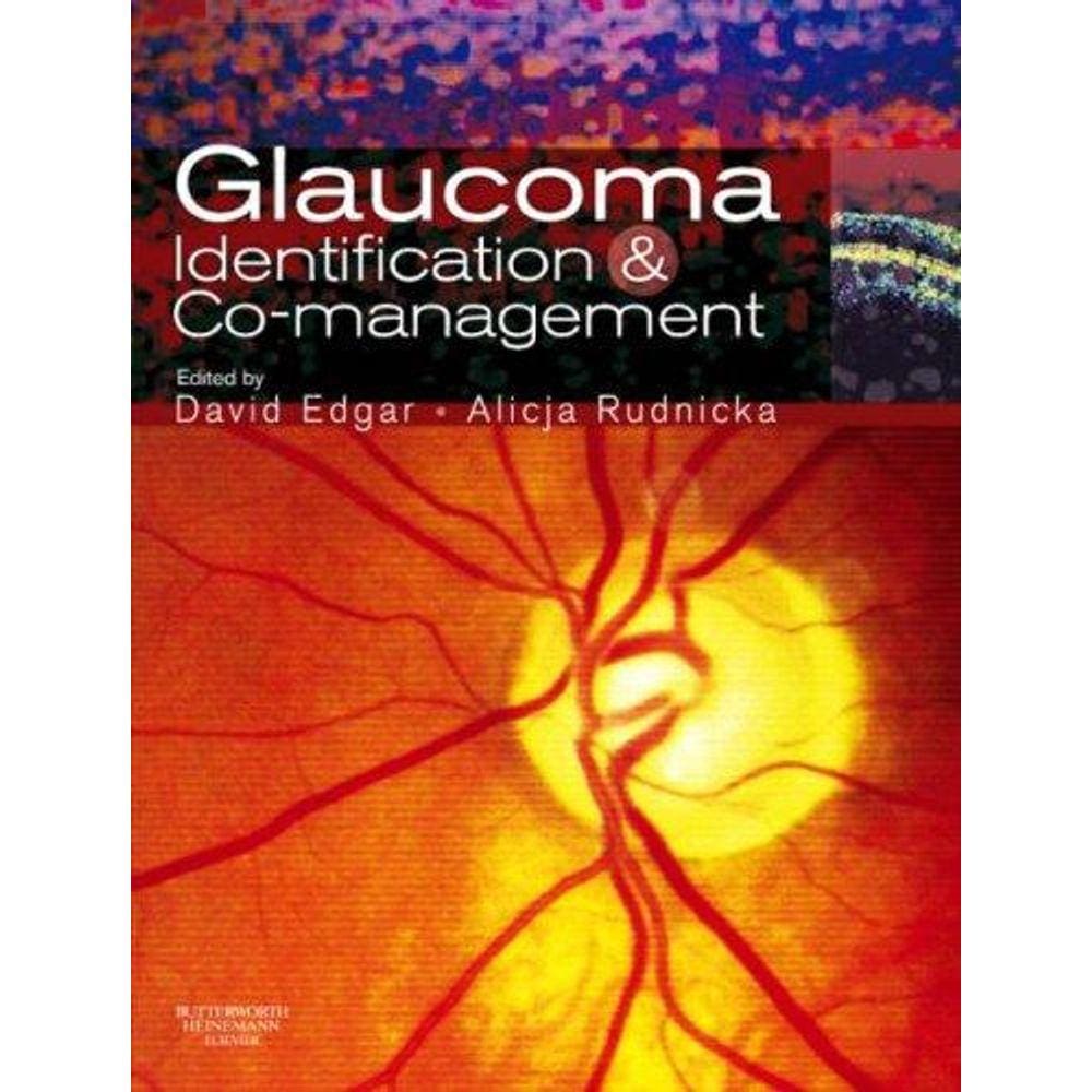Glaucoma Co-Management